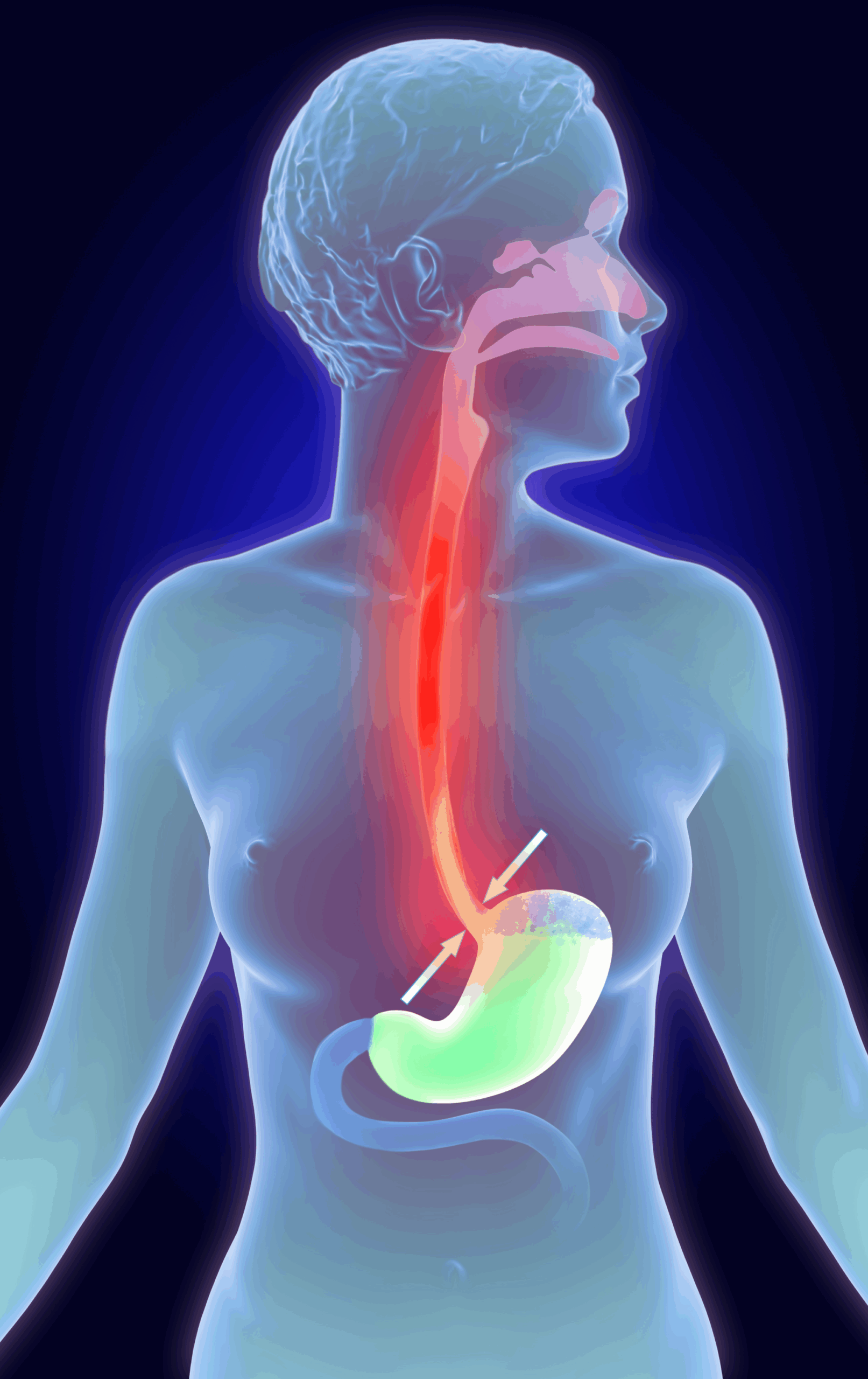 Soffri di reflusso gastroesofageo e per questo oltre a non digerire bene non riesci neanche a riposare come dovresti? Aiutati con la Riflessologia Plantare